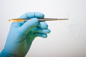 Surgical Never Event - Retained Needle